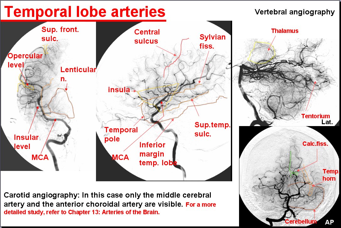 Salamons Neuroanatomy And Neurovasculature Web Atlas Resource